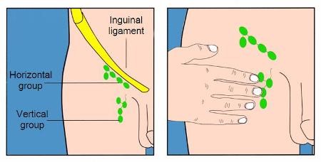 fig7-8