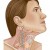 Inflamación de los ganglios linfáticos en el cuello (Causas y Remedios)